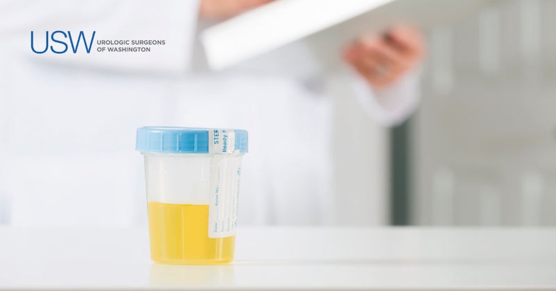 Brightly colored urine sample in specimen cup sits on counter in focus as urologist in white coat makes notes on clipboard in background. Urologic Surgeons of Washington logo at top left.